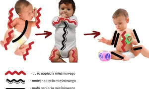 Ewolucja napięcia mięśniowego u niemowlaka: od silnego, przez umiarkowane, do swobodnego.