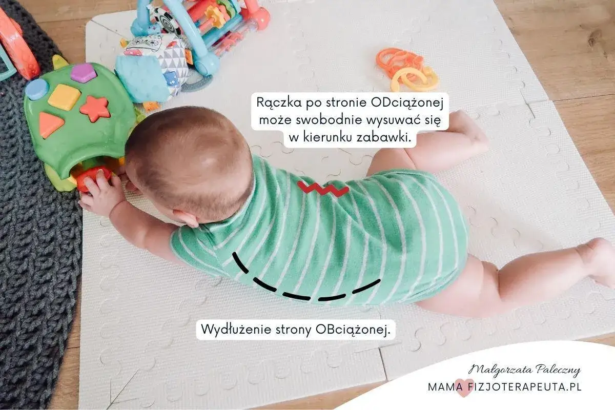 Dziecko na brzuchu, z zabawką. Pokazuje konsekwencje nie kładzenia dziecka na brzuchu: wydłużenie strony obciążonej, rączka po stronie odciążonej swobodnie się wysuwa.